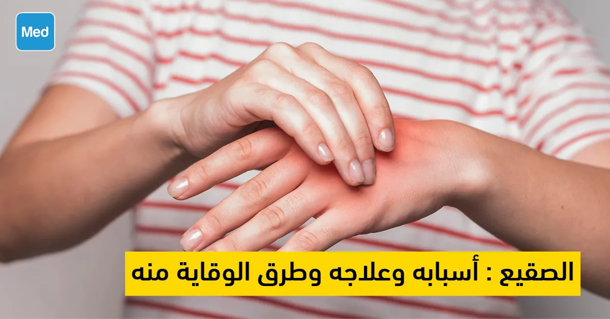 الصقيع : أسبابه وعلاجه وطرق الوقاية منه